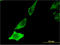 Brain Derived Neurotrophic Factor antibody, LS-C196746, Lifespan Biosciences, Immunofluorescence image 