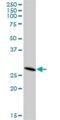 Dehydrogenase/Reductase 4 Like 2 antibody, H00317749-B01P, Novus Biologicals, Western Blot image 