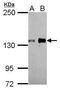 AXL Receptor Tyrosine Kinase antibody, GTX108560, GeneTex, Western Blot image 