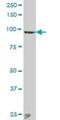 Anaphase Promoting Complex Subunit 2 antibody, H00029882-B01P, Novus Biologicals, Western Blot image 