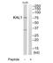 Anosmin 1 antibody, TA314118, Origene, Western Blot image 