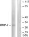 Matrix Metallopeptidase 7 antibody, LS-B7612, Lifespan Biosciences, Western Blot image 