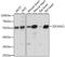 Zinc finger and SCAN domain-containing protein 21 antibody, A15330, ABclonal Technology, Western Blot image 