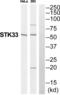 Serine/Threonine Kinase 33 antibody, abx015171, Abbexa, Western Blot image 