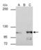 Catenin Alpha 1 antibody, PA5-29247, Invitrogen Antibodies, Immunoprecipitation image 