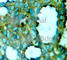 P21 (RAC1) Activated Kinase 1 antibody, AP0186, ABclonal Technology, Immunohistochemistry paraffin image 