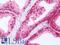 Retinoic Acid Receptor Gamma antibody, LS-B10760, Lifespan Biosciences, Immunohistochemistry paraffin image 