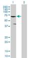 CNKSR Family Member 3 antibody, H00154043-B01P, Novus Biologicals, Western Blot image 
