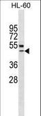 Vitamin D Receptor antibody, LS-C157346, Lifespan Biosciences, Western Blot image 