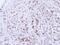 NIMA Related Kinase 4 antibody, PA5-21458, Invitrogen Antibodies, Immunohistochemistry paraffin image 