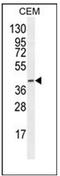 Coagulation Factor VIII Associated 3 antibody, AP51497PU-N, Origene, Western Blot image 