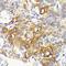 Inhibitor Of Nuclear Factor Kappa B Kinase Subunit Beta antibody, GTX01197, GeneTex, Immunohistochemistry paraffin image 