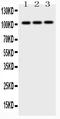 Adaptor Related Protein Complex 2 Subunit Beta 1 antibody, LS-C662247, Lifespan Biosciences, Western Blot image 