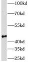5-Azacytidine Induced 2 antibody, FNab00758, FineTest, Western Blot image 