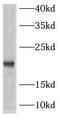 Actin Related Protein 2/3 Complex Subunit 5 antibody, FNab00604, FineTest, Western Blot image 