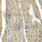Nucleolar Protein 3 antibody, A6319, ABclonal Technology, Immunohistochemistry paraffin image 