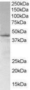 SAM Domain, SH3 Domain And Nuclear Localization Signals 1 antibody, NB300-976, Novus Biologicals, Western Blot image 