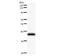 JunB Proto-Oncogene, AP-1 Transcription Factor Subunit antibody, LS-C342547, Lifespan Biosciences, Western Blot image 