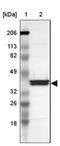 Apolipoprotein A4 antibody, NBP1-86164, Novus Biologicals, Western Blot image 