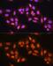 Protein Arginine Methyltransferase 5 antibody, GTX32810, GeneTex, Immunofluorescence image 
