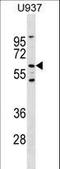 Receptor Like Tyrosine Kinase antibody, LS-C158250, Lifespan Biosciences, Western Blot image 