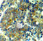 Ribosomal Protein S6 Kinase B1 antibody, AP0246, ABclonal Technology, Immunohistochemistry paraffin image 