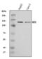 ATP Binding Cassette Subfamily B Member 1 antibody, A00049-4, Boster Biological Technology, Western Blot image 