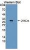 Insulin Receptor Substrate 4 antibody, LS-C663455, Lifespan Biosciences, Western Blot image 