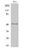 Zinc Finger Protein 436 antibody, A14458-1, Boster Biological Technology, Western Blot image 