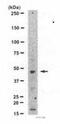 Nuclear Receptor Subfamily 2 Group E Member 3 antibody, MBS623198, MyBioSource, Western Blot image 