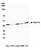 Actin Related Protein 2/3 Complex Subunit 1B antibody, NBP1-46220, Novus Biologicals, Western Blot image 