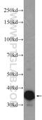 Troponin T3, Fast Skeletal Type antibody, 19729-1-AP, Proteintech Group, Western Blot image 