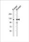 Neuroligin-3 antibody, PA5-72240, Invitrogen Antibodies, Western Blot image 