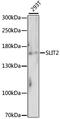 Slit Guidance Ligand 2 antibody, LS-C750323, Lifespan Biosciences, Western Blot image 