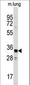Annexin A3 antibody, LS-C97320, Lifespan Biosciences, Western Blot image 