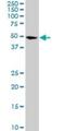 Cyclin Dependent Kinase 8 antibody, H00001024-M01, Novus Biologicals, Western Blot image 