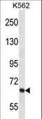 Potassium Voltage-Gated Channel Subfamily D Member 2 antibody, LS-C165417, Lifespan Biosciences, Western Blot image 