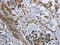 Growth Differentiation Factor 3 antibody, CSB-PA558316, Cusabio, Immunohistochemistry paraffin image 