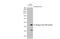 Dengue virus antibody, GTX630557, GeneTex, Western Blot image 