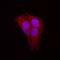 Signal Transducer And Activator Of Transcription 5B antibody, MAB15841, R&D Systems, Immunofluorescence image 