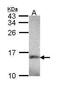 NADH:Ubiquinone Oxidoreductase Subunit A5 antibody, PA5-22143, Invitrogen Antibodies, Western Blot image 