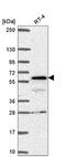 SP110 Nuclear Body Protein antibody, NBP2-56189, Novus Biologicals, Western Blot image 