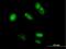 Mediator Complex Subunit 20 antibody, H00009477-B01P, Novus Biologicals, Immunocytochemistry image 