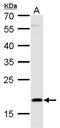 Thymic Stromal Lymphopoietin antibody, GTX129571, GeneTex, Western Blot image 