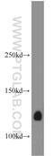 CCR4-NOT Transcription Complex Subunit 3 antibody, 11135-1-AP, Proteintech Group, Western Blot image 