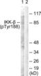 Inhibitor Of Nuclear Factor Kappa B Kinase Subunit Beta antibody, LS-C199104, Lifespan Biosciences, Western Blot image 