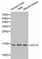 ISG15 Ubiquitin Like Modifier antibody, LS-C192440, Lifespan Biosciences, Western Blot image 