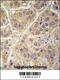 Seryl-TRNA Synthetase 2, Mitochondrial antibody, 63-228, ProSci, Immunohistochemistry paraffin image 