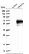 Mitogen-Activated Protein Kinase Kinase Kinase 8 antibody, NBP1-86569, Novus Biologicals, Western Blot image 