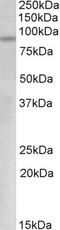 Sterol O-acyltransferase 1 antibody, 42-494, ProSci, Western Blot image 